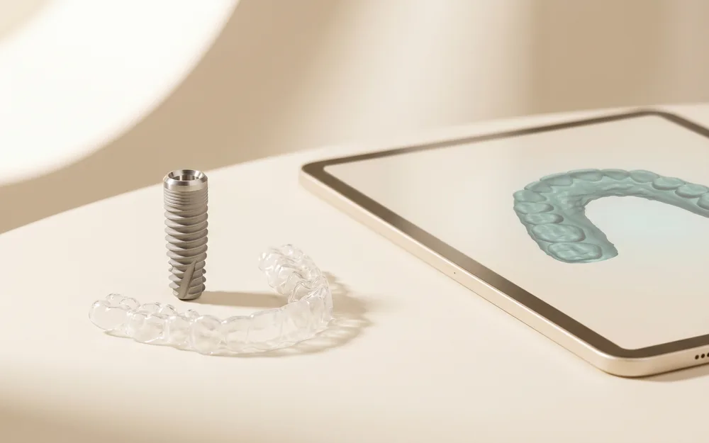 Implantes dentales